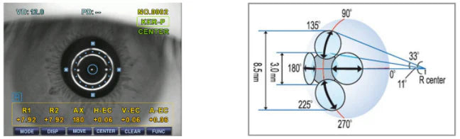 Autorefractómetro Con Queratómetro Ezer 1235ERK-9100